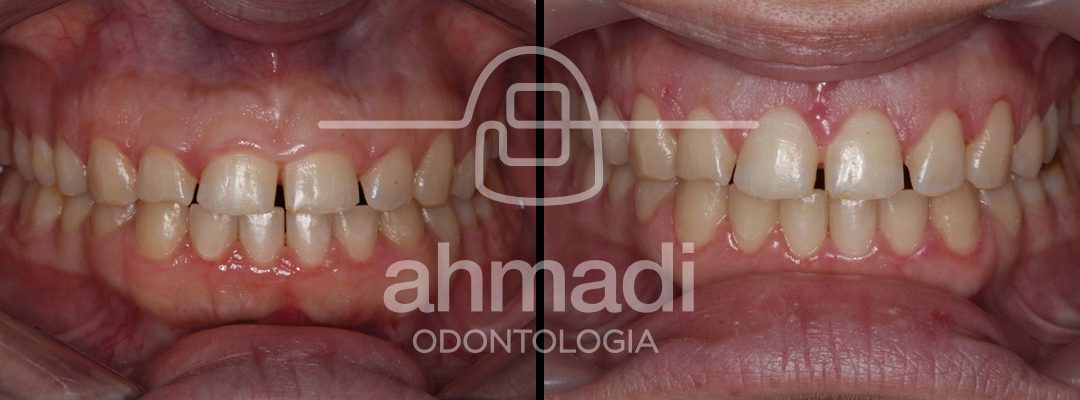 Periodoncia